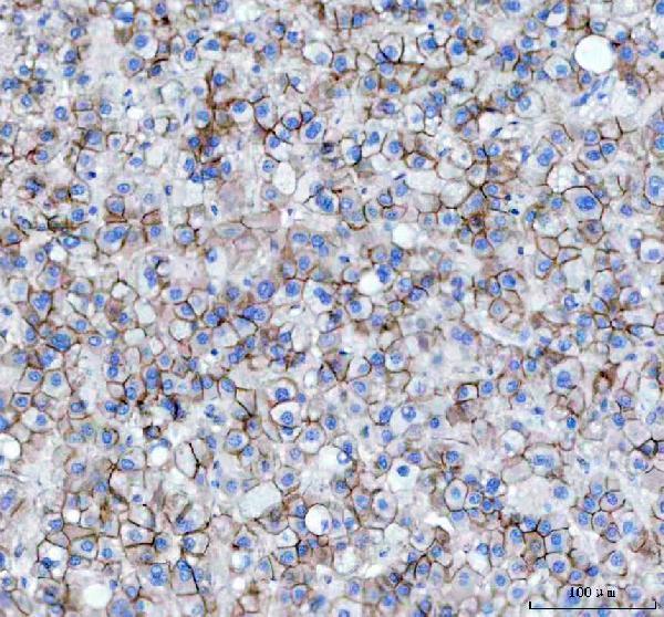 m00004 1 beta_catenin primary antibodies ihc testing 3