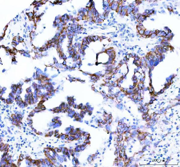 m00004 1 beta_catenin primary antibodies ihc testing 4