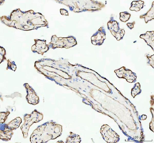m00004 1 beta_catenin primary antibodies ihc testing 5