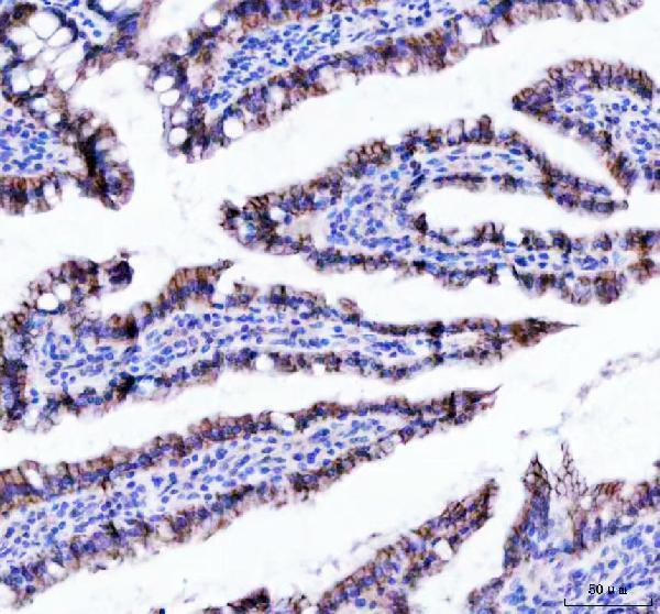 m00004 1 beta_catenin primary antibodies ihc testing 6