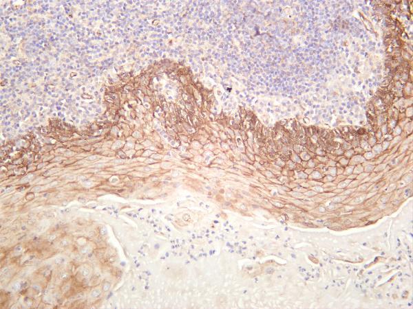 m00004 7 ctnnb1 primary antibodies ihc testing 1