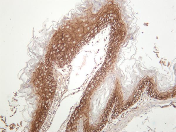 m00004 7 ctnnb1 primary antibodies ihc testing 2