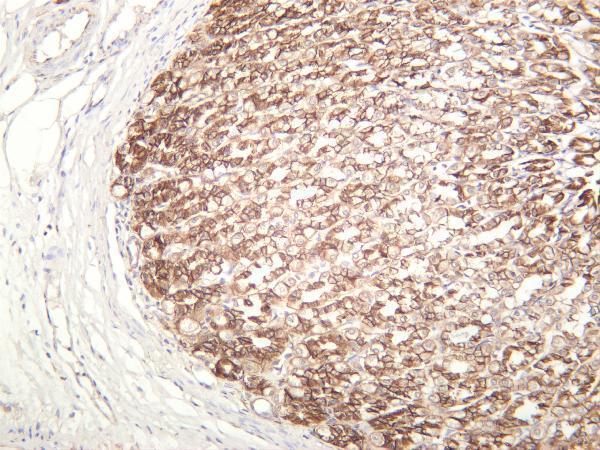 m00004 7 ctnnb1 primary antibodies ihc testing 3