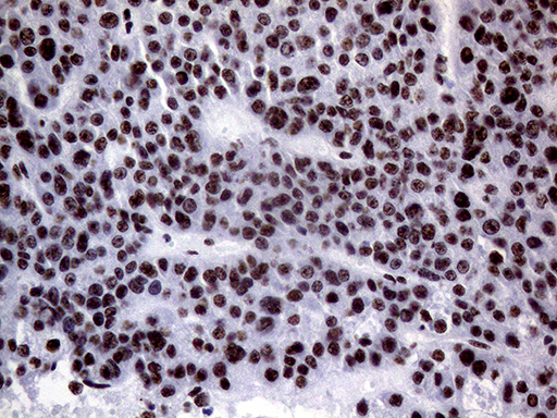 m00005 1 anti brca1 mouse monoclonal antibody clone id oti5d10 ihc testing 10