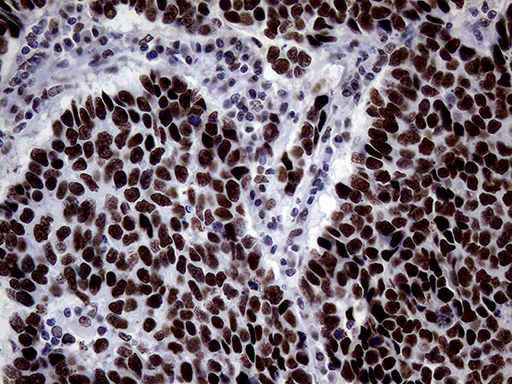 m00005 1 anti brca1 mouse monoclonal antibody clone id oti5d10 ihc testing 2