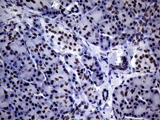 m00005 1 anti brca1 mouse monoclonal antibody clone id oti5d10 ihc testing 3