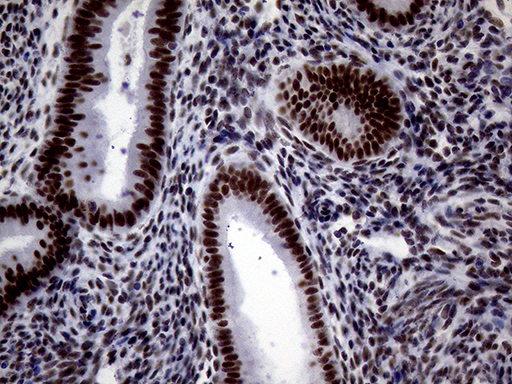 m00005 1 anti brca1 mouse monoclonal antibody clone id oti5d10 ihc testing 4