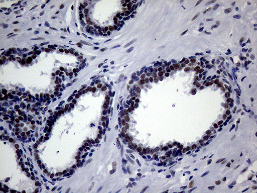 m00005 1 anti brca1 mouse monoclonal antibody clone id oti5d10 ihc testing 5