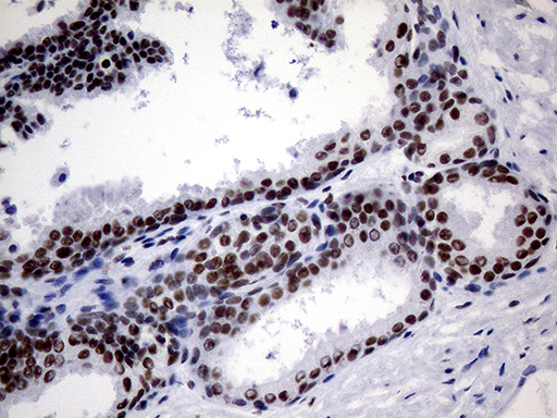 m00005 1 anti brca1 mouse monoclonal antibody clone id oti5d10 ihc testing 6