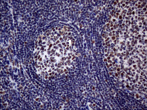 m00005 1 anti brca1 mouse monoclonal antibody clone id oti5d10 ihc testing 7