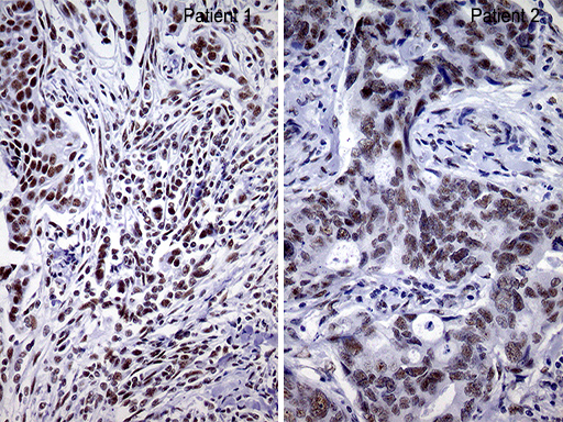 m00005 1 anti brca1 mouse monoclonal antibody clone id oti5d10 ihc testing 8