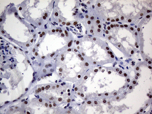 m00005 1 anti brca1 mouse monoclonal antibody clone id oti5d10 ihc testing 9