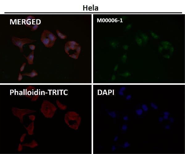 Anti-PTEN antibody used in autism research