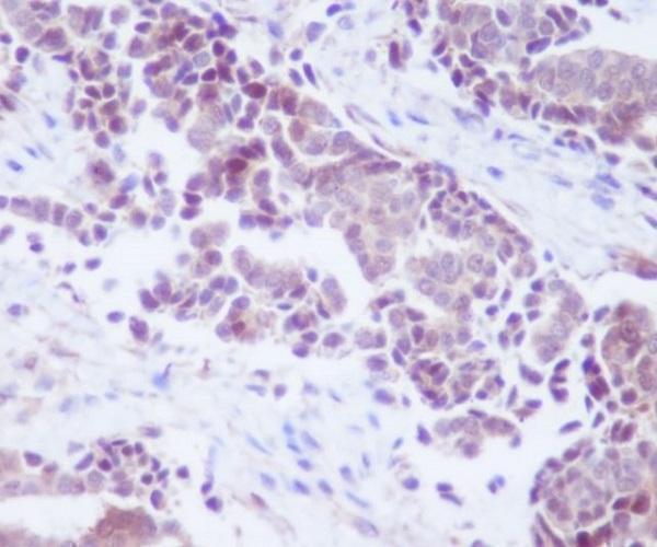 m00006 1 ihc
