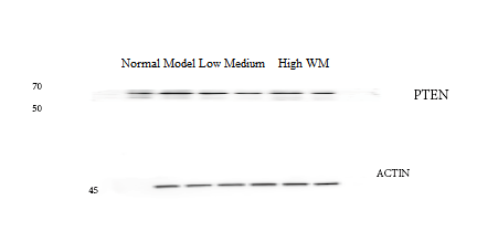 Western blot analysis of PTEN using anti-PTEN antibody (M00006-2)