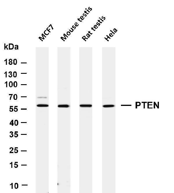 Various whole cell lysates were separated by 4-20% SDS-PAGE, and the membrane was blotted with anti-PTEN antibody