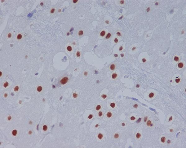 m00007 1 ihc