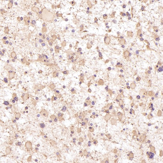 m00007 1 ihc8