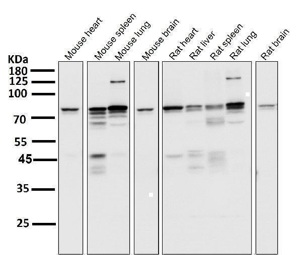 All lanes use the Antibody at 1:5K dilution for 1 hour at room temperature