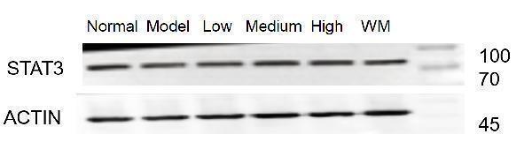 Western blot analysis of STAT3 using anti-STAT3 antibody (M00007)