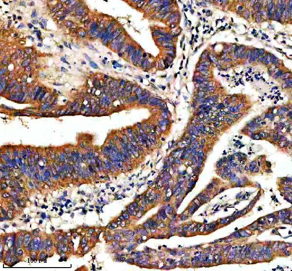 m00008 apc primary antibodies ihc testing 3
