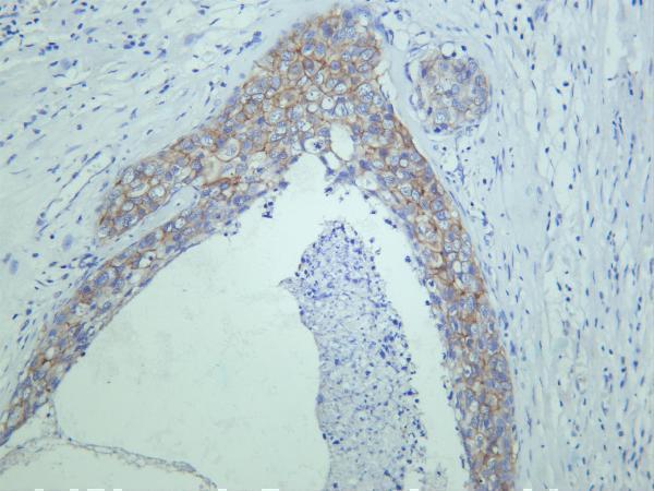 m00010 21 erbb2 primary antibodies ihc testing 1