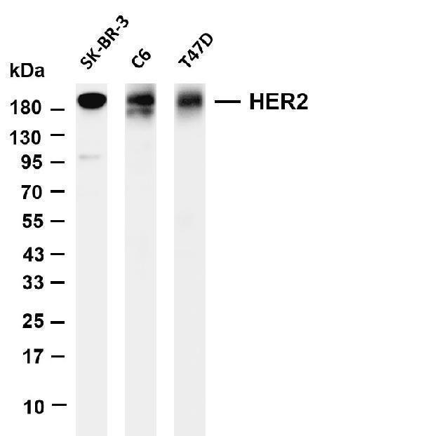 m00010 21 erbb2 primary antibodies wb testing 1
