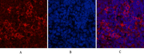 m00010 3 erbb2 primary antibodies if testing 1