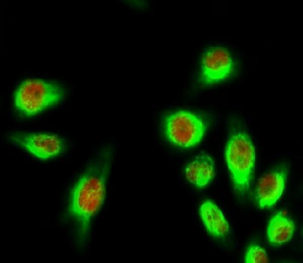 m00010 3 erbb2 primary antibodies if testing 5