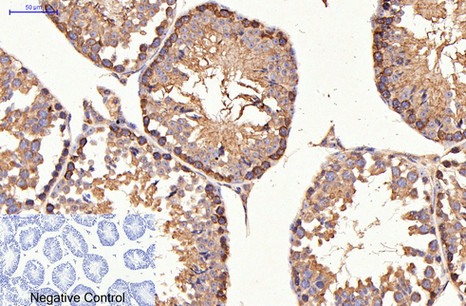 m00010 3 erbb2 primary antibodies ihc testing 4