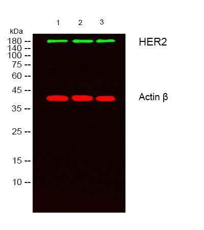 m00010 3 erbb2 primary antibodies wb testing 2