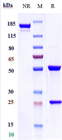 m00010 5 sds page