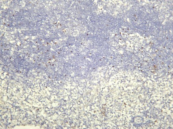 Mouse spleen was stained with anti-FOXP3 rabbit antibody