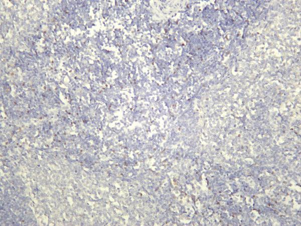 Rat spleen was stained with anti-FOXP3 rabbit antibody