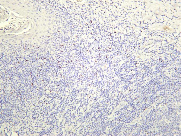 Human tonsil was stained with anti-FOXP3 rabbit antibody