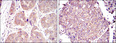 m00013 2 hif1a primary antibodyes ihc testing 2