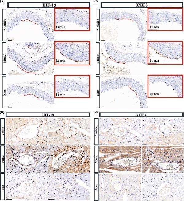 Activation of HIF-1α/BNIP3 signaling pathway in artery of KD murine model