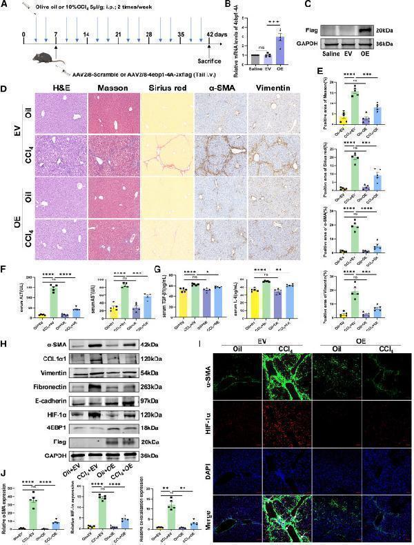 (H) The protein expression of α-SMA, COL1α1, vimentin, fibronectin, E-cadherin, 4EBP1, FLAG, and HIF-1α in liver tissues analyzed using western blotting