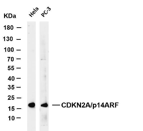 Various whole cell lysates were separated by 4-20% SDS-PAGE, and the membrane was blotted with anti-CDKN2A/p14ARF antibody