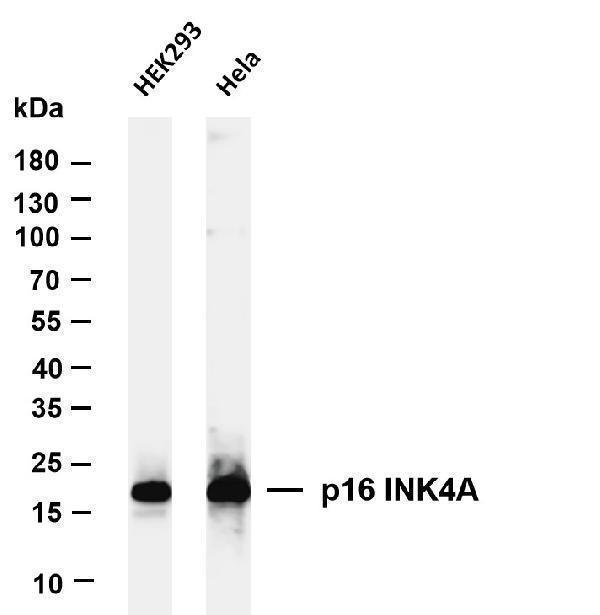 Various whole cell lysates were separated by 4-20% SDS-PAGE, and the membrane was blotted with anti-p16 INK4A antibody