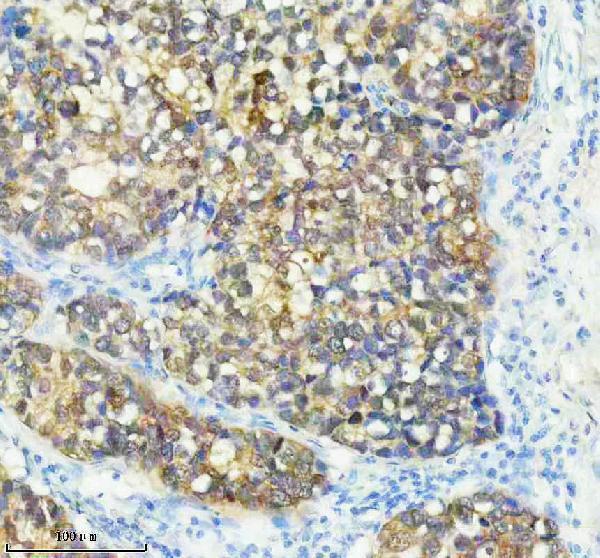 IHC analysis of CDKN2A using anti-CDKN2A antibody (M00016-5)