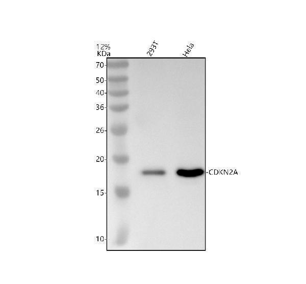 Western blot analysis of CDKN2A using anti-CDKN2A antibody (M00016-5)