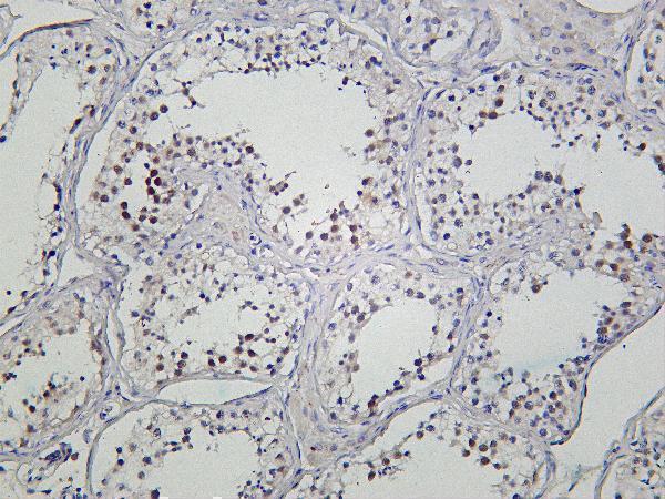 Human testis was stained with Anti-SIRT1 rabbit antibody