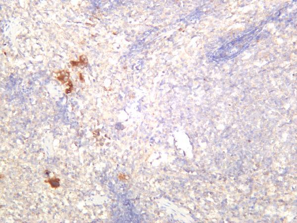 m00019 11 tgfb1 primary antibodies ihc testing 2