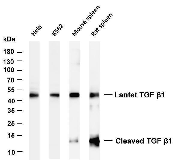 Various whole cell lysates were separated by 4-20% SDS-PAGE, and the membrane was blotted with anti-TGF β1 antibody