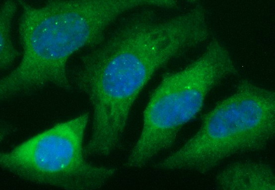 m00019 3 anti tgf beta 1 tgfb1 mouse monoclonal antibody clone id oti3b6 if testing 7