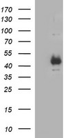 HEK293T cells were transfected with the pCMV6-ENTRY control (Left lane) or pCMV6-ENTRY TGFB1 (Right lane) cDNA for 48 hrs and lysed