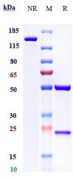 Anti-TGFb1 Reference Antibody (Metelimumab) on SDS-PAGE under reducing (R) condition