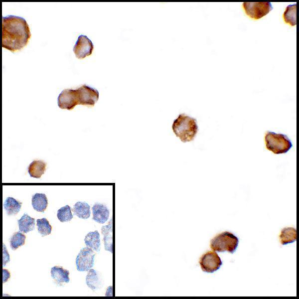 Immunocytochemistry of CTLA-4 in transfected HEK293 cells with CTLA-4 antibody at 5 μg/mL