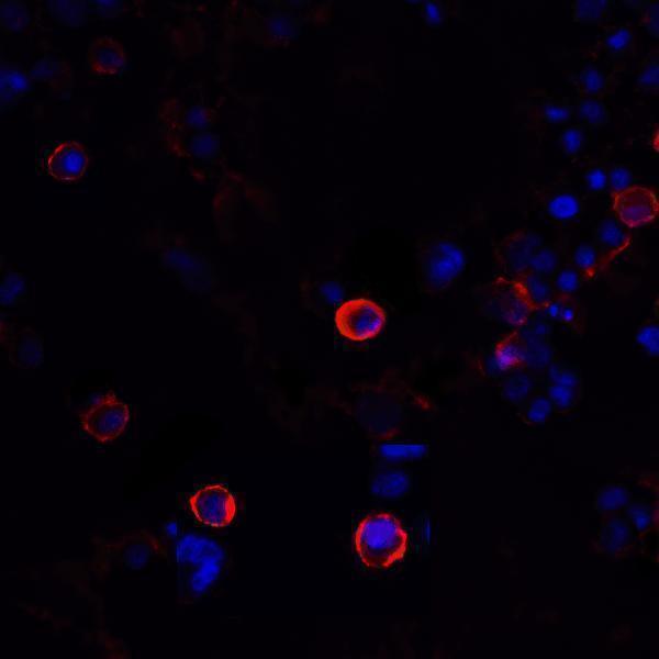 Immunofluorescence of CTLA-4 in transfected HEK293 cells with CTLA-4 antibody at 20 μg/mL